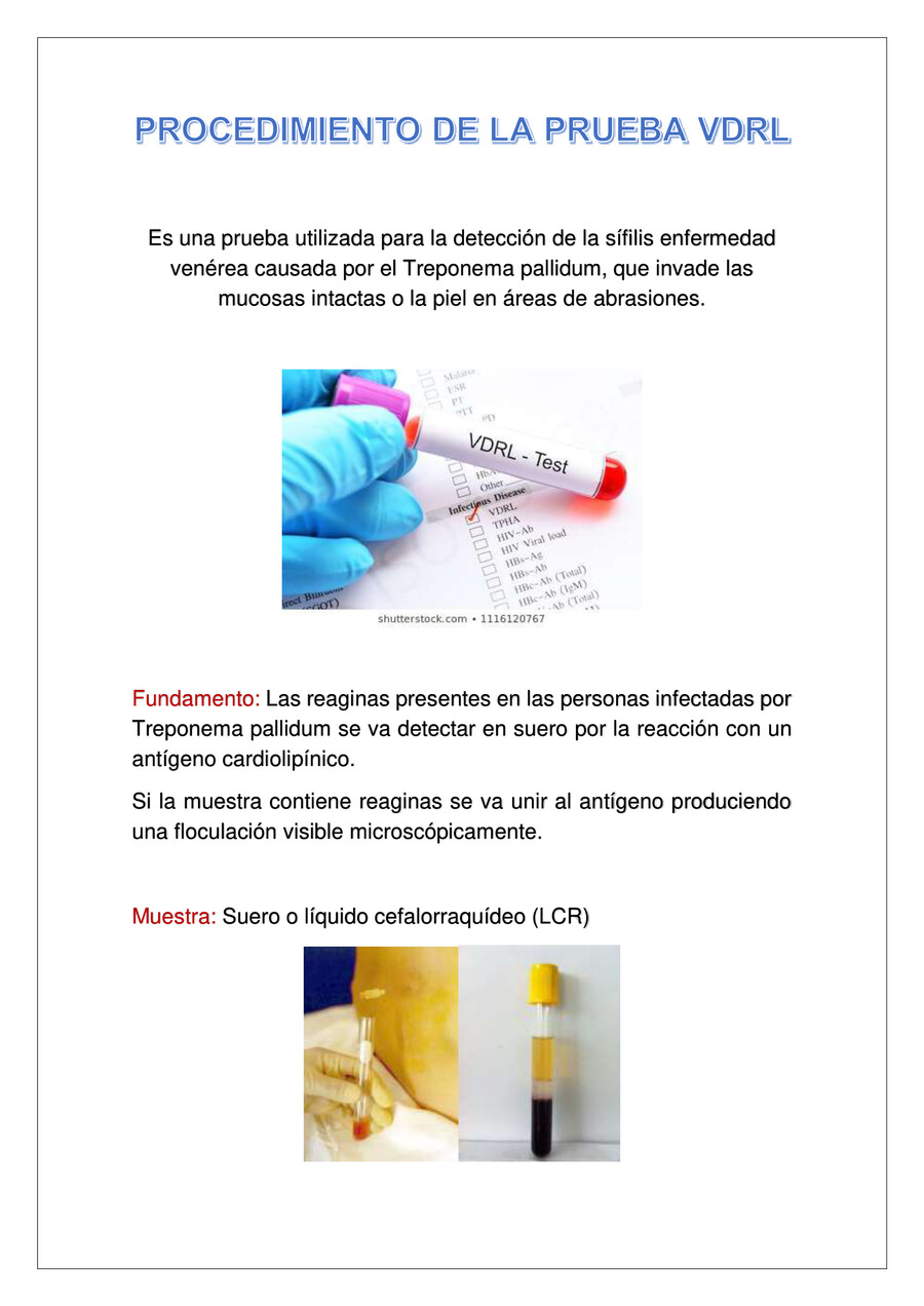 PROCEDIMIENTO DE LA PRUEBA VDRL by