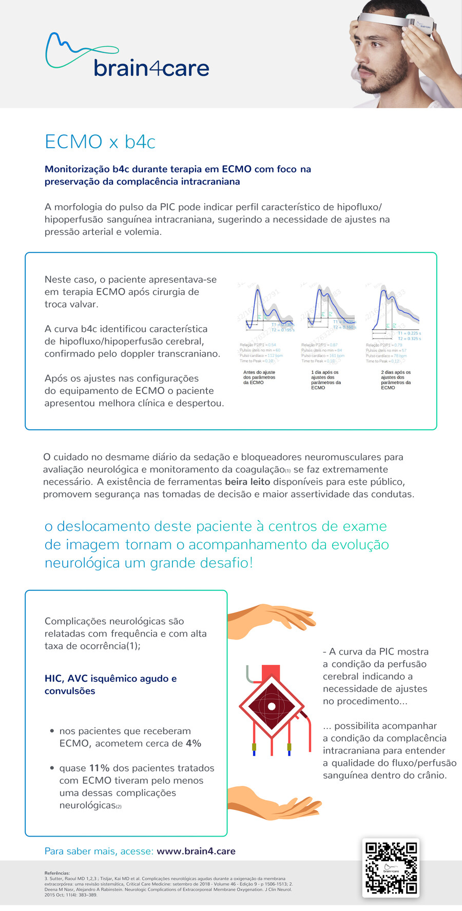 ECMO - brain4care - Icu in buzius by WDCOM - Flipsnack