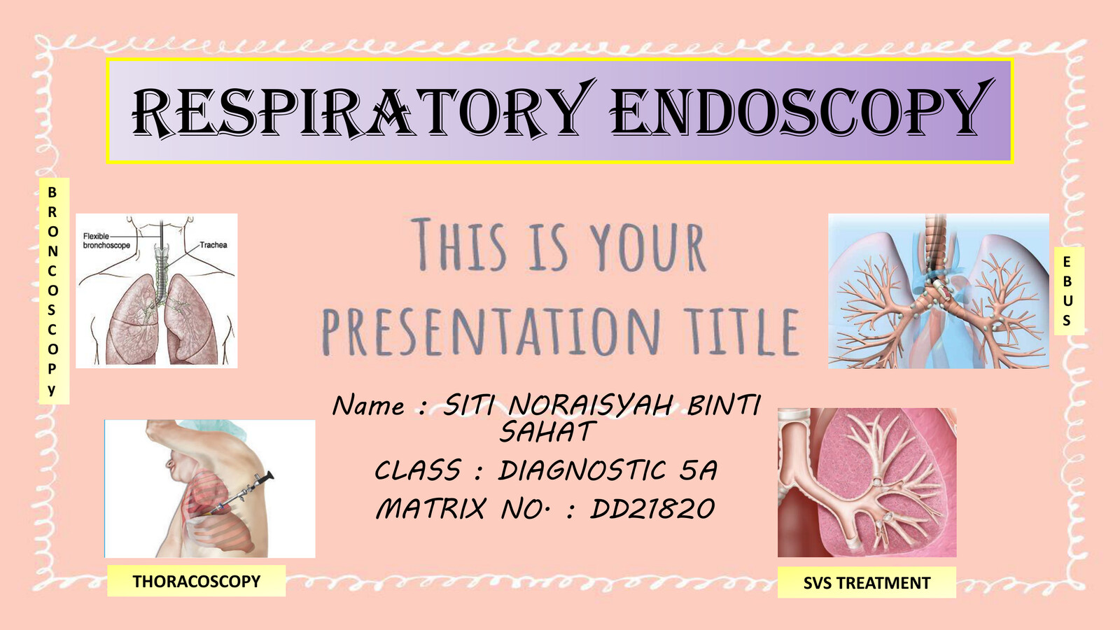 RESPIRATORY ENDOSCOPY by Aisyah cantik Flipsnack